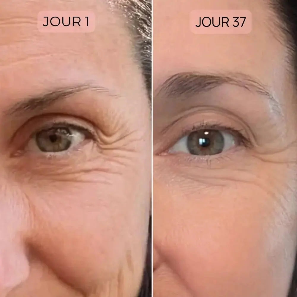 Charlotte 52 ans | Masque LED