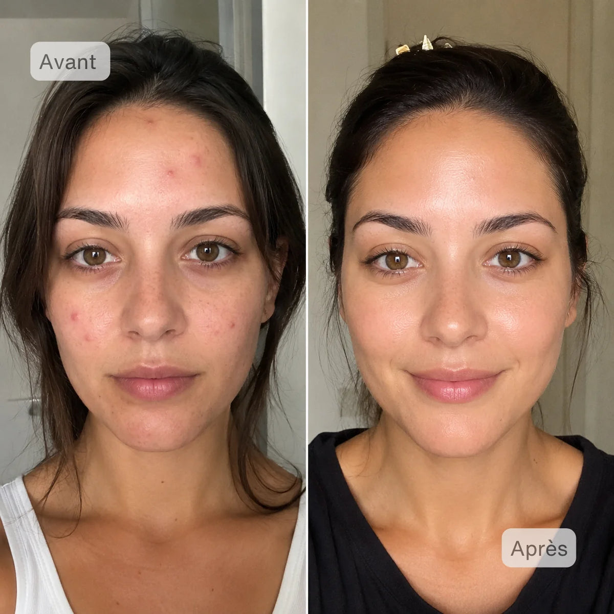 Erika 27 ans | Masque LED
